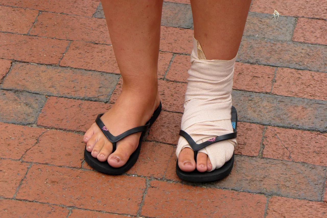 Ankle wrapped in white tape and bandage